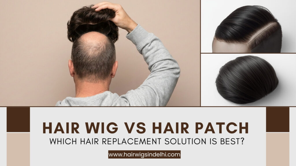 Hair Wig vs Hair Patch – Which Hair Replacement Solution Is Best?
