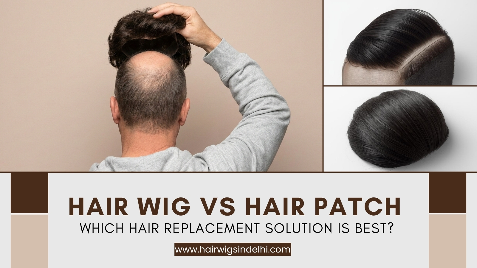Hair Wig vs Hair Patch – Which Hair Replacement Solution Is Best?
