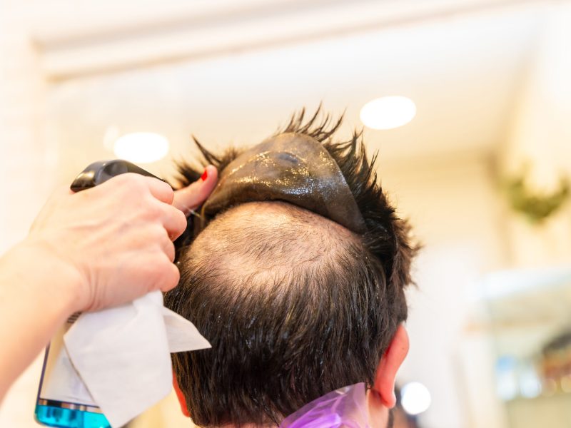 Rear view close-up of a Hairdresser removing the capillary prosthesis of a client using water spray